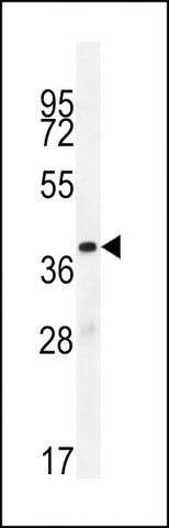 ANTI-OR10J5 (C-TERM) antibody produced in rabbit