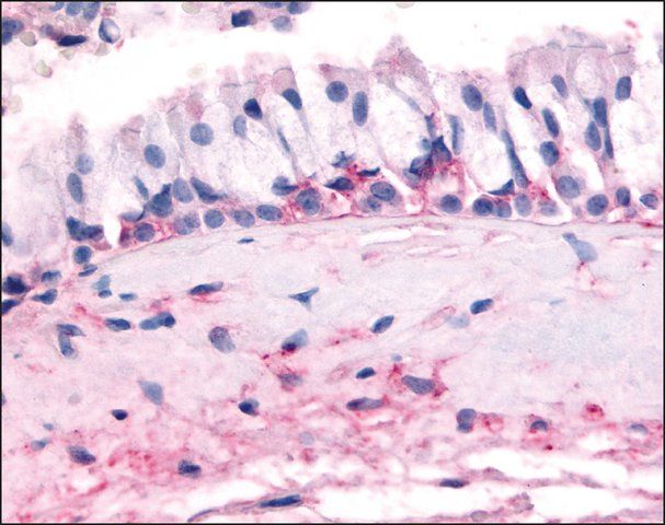 Anti-OR10J5 antibody produced in rabbit