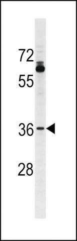ANTI-OR51T1(C-TERMINAL) antibody produced in rabbit