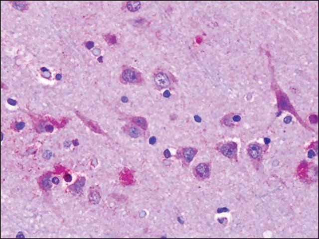 Anti-OR6N1 antibody produced in rabbit