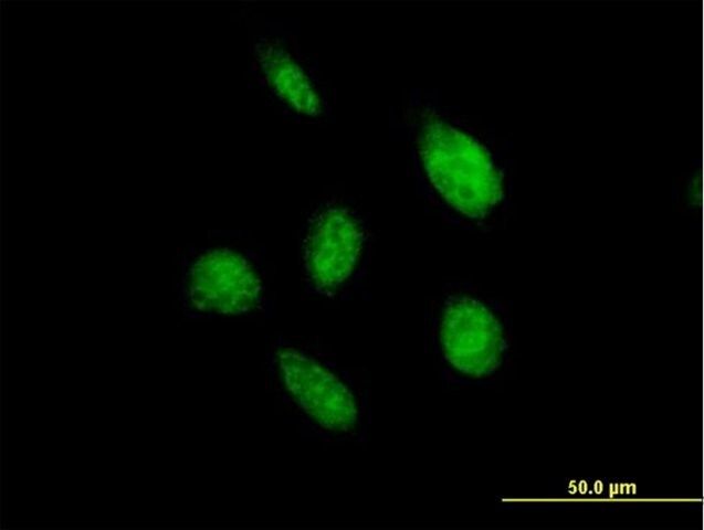 Anti-OVOL2 antibody produced in mouse