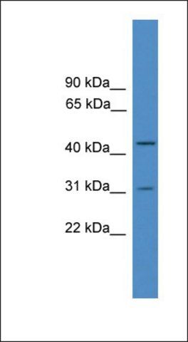 Anti-OTUD6A antibody produced in rabbit