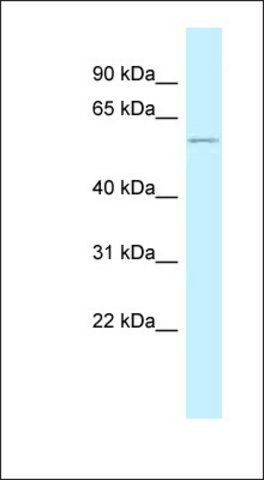 Anti-PEPD antibody produced in rabbit