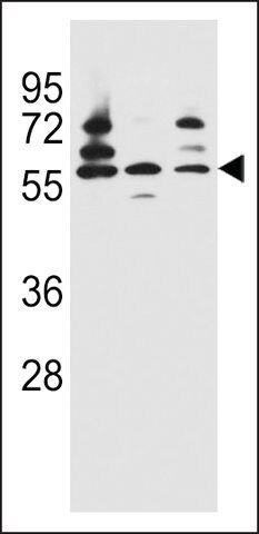ANTI-PDP1 (CENTER) antibody produced in rabbit