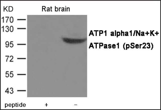 Anti-phospho-ATP1 α1/Na+K+ (pSer<sup>23</sup>) antibody produced in rabbit