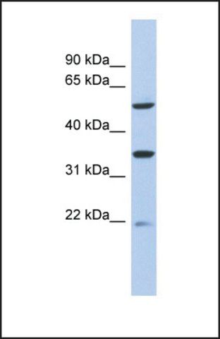Anti-MGC34821 antibody produced in rabbit