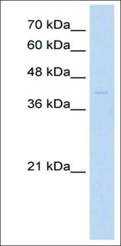 Anti-MKX (AB2) antibody produced in rabbit