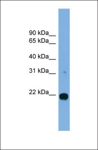 Anti-MITD1 antibody produced in rabbit