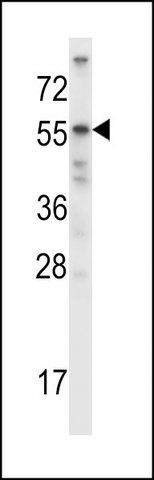 ANTI-MOUSE ACVR2B (CENTER) antibody produced in rabbit