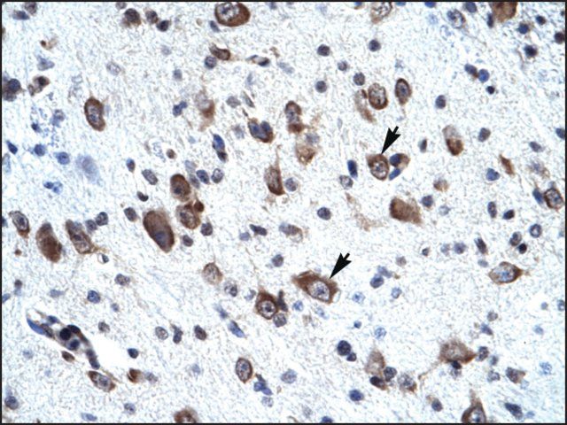Anti-MORF4L2 (AB1) antibody produced in rabbit
