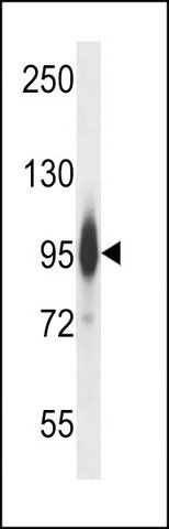 ANTI-MOUSE PRKCE (N-TERM) antibody produced in rabbit
