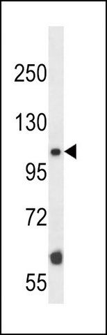 ANTI-MOUSE TAOK2 (CENTER) antibody produced in rabbit