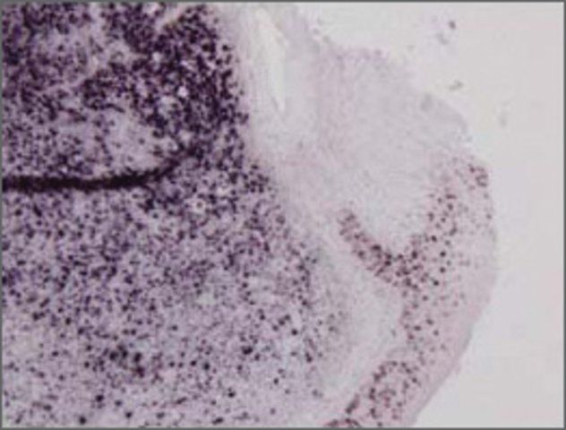 Anti-MSH6, (N-terminal) antibody produced in rabbit
