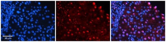 Anti-MSN antibody produced in rabbit