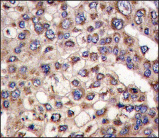 Anti-MTMR4 (C-term) antibody produced in rabbit
