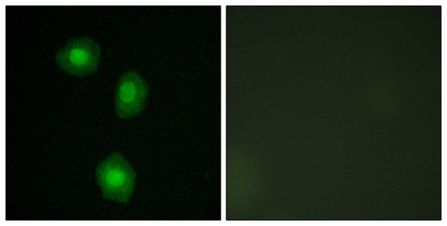 Anti-MSK1 antibody produced in rabbit