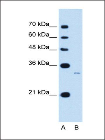 Anti-MUC3B antibody produced in rabbit