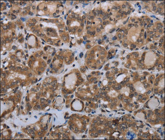Anti-MTSS1 antibody produced in rabbit