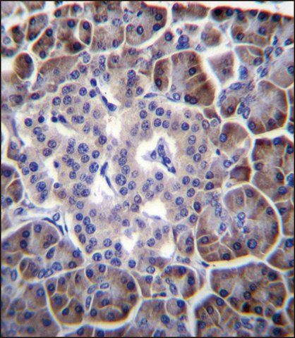 ANTI-MYBPHL (N-TERM) antibody produced in rabbit