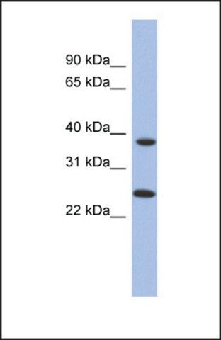 Anti-MTRF1L, (N-terminal) antibody produced in rabbit