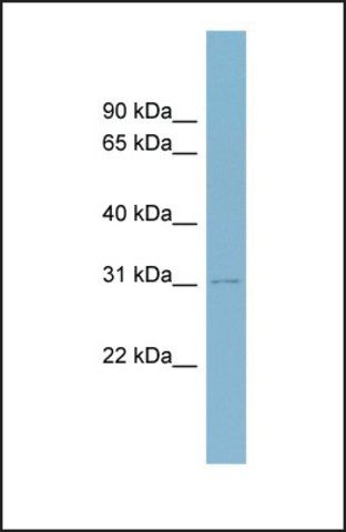Anti-MYOD1 antibody produced in rabbit