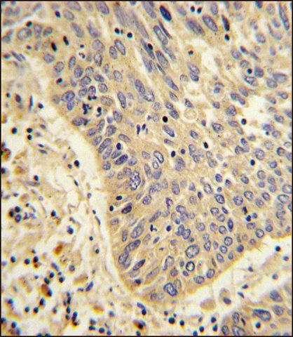 ANTI-MYOGEF (N-TERM) antibody produced in rabbit