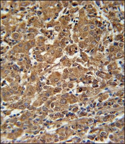 ANTI-N4BP3 (N-TERM) antibody produced in rabbit