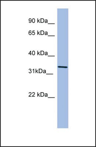 Anti-KIR2DL4 antibody produced in rabbit