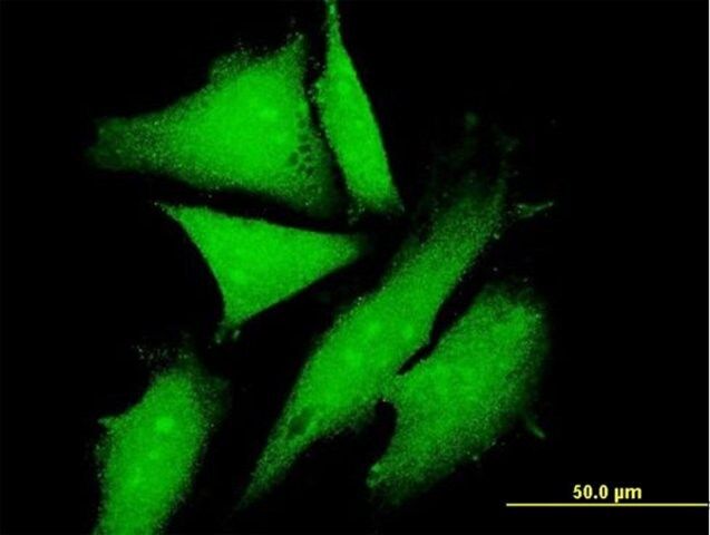 Anti-KLC2 antibody produced in mouse
