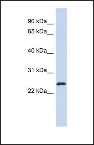 Anti-KLF16 antibody produced in rabbit