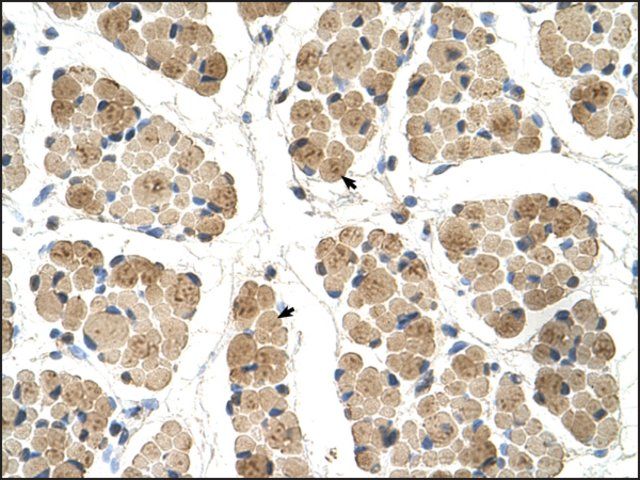 Anti-KLHL31 antibody produced in rabbit