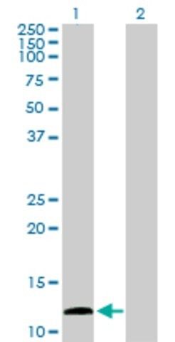 Anti-KISS1 antibody produced in rabbit