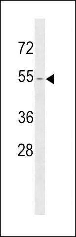 ANTI-KRT79 (CENTER) antibody produced in rabbit