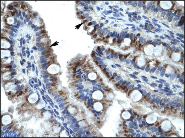 Anti-KRT15 antibody produced in rabbit