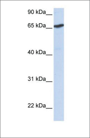 Anti-L3MBTL (ab2) antibody produced in rabbit