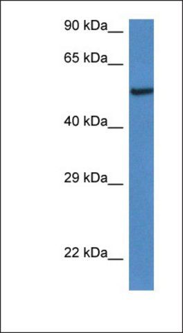 Anti-LACC1 antibody produced in rabbit