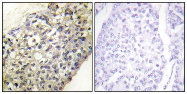 Anti-LATH antibody produced in rabbit