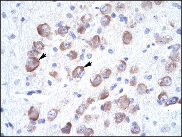 Anti-LARP2 antibody produced in rabbit
