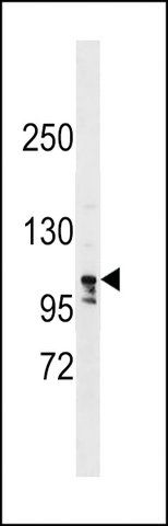 ANTI-LARP1B(C-TERMINAL) antibody produced in rabbit