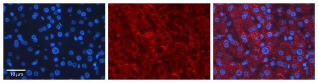 Anti-LCAT (AB1) antibody produced in rabbit