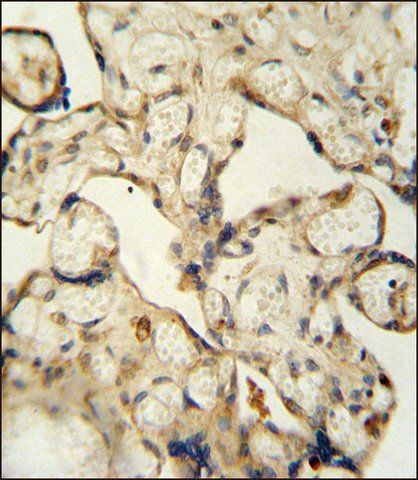 ANTI-LCA5L (C-TERM) antibody produced in rabbit
