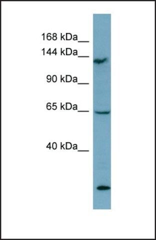 Anti-LATS1 antibody produced in rabbit