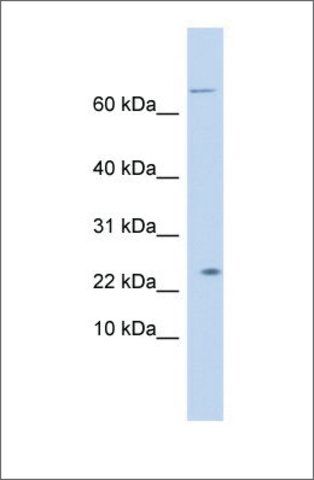 Anti-LOC441956 antibody produced in rabbit