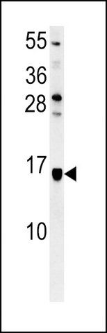 ANTI-LOC552889 (CENTER) antibody produced in rabbit