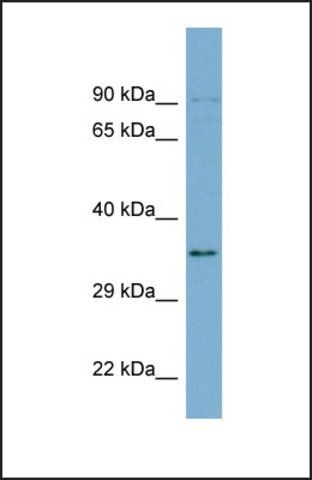 Anti-LOC51035 antibody produced in rabbit