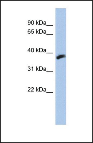 Anti-LOC606495, (N-terminal) antibody produced in rabbit