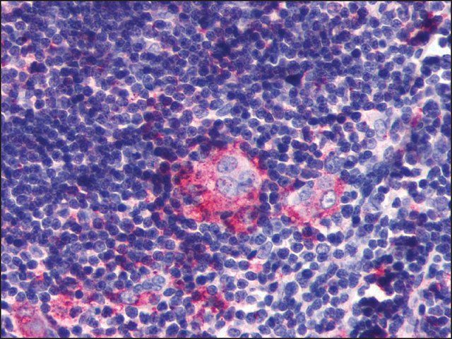 Anti-LPAR6 / P2RY5 antibody produced in rabbit