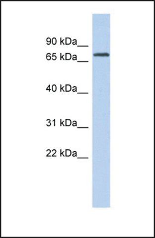 Anti-LPP, (N-terminal) antibody produced in rabbit