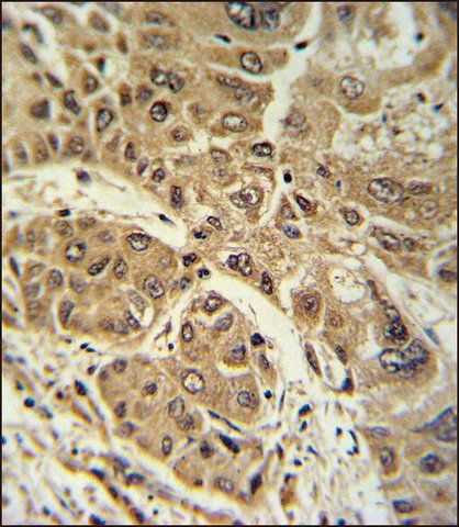 ANTI-LPIN2 (CENTER) antibody produced in rabbit