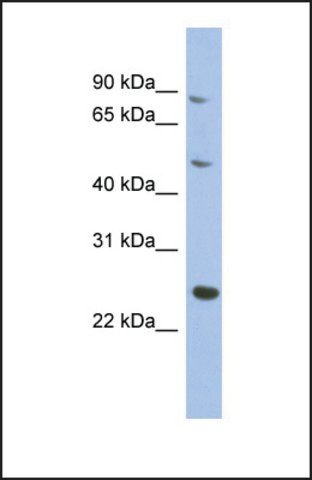 Anti-MATN3 antibody produced in rabbit